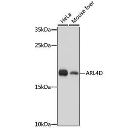Western Blot - Anti-ARL4D Antibody (A92538) - Antibodies.com
