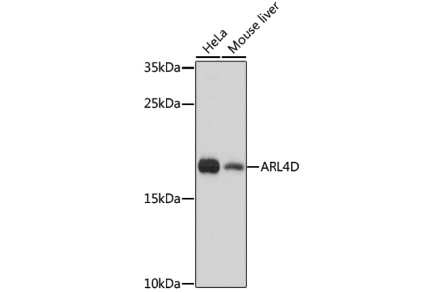 Western Blot - Anti-ARL4D Antibody (A92538) - Antibodies.com