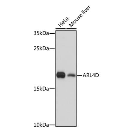 Western Blot - Anti-ARL4D Antibody (A92538) - Antibodies.com