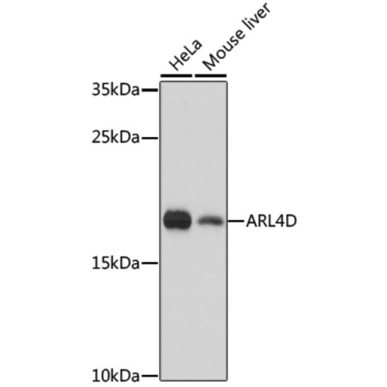 Western Blot - Anti-ARL4D Antibody (A92538) - Antibodies.com