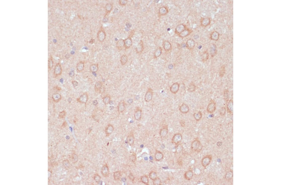 Immunohistochemistry - Anti-ARL4D Antibody (A92538) - Antibodies.com