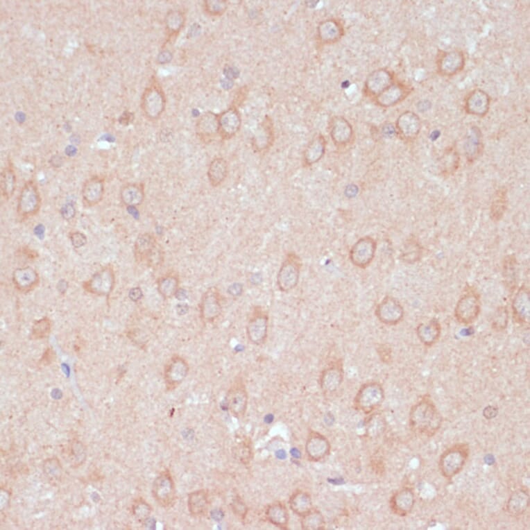 Immunohistochemistry - Anti-ARL4D Antibody (A92538) - Antibodies.com