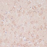 Immunohistochemistry - Anti-ARL4D Antibody (A92538) - Antibodies.com