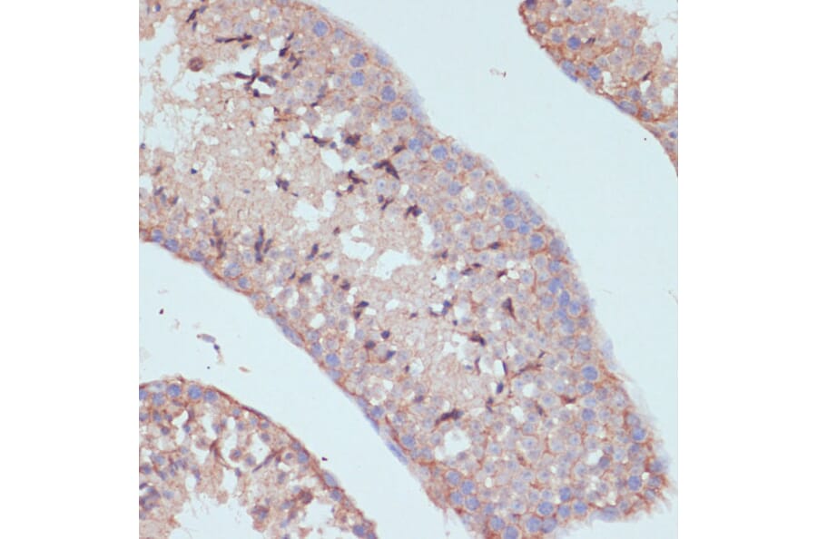 Immunohistochemistry - Anti-ARL4D Antibody (A92538) - Antibodies.com