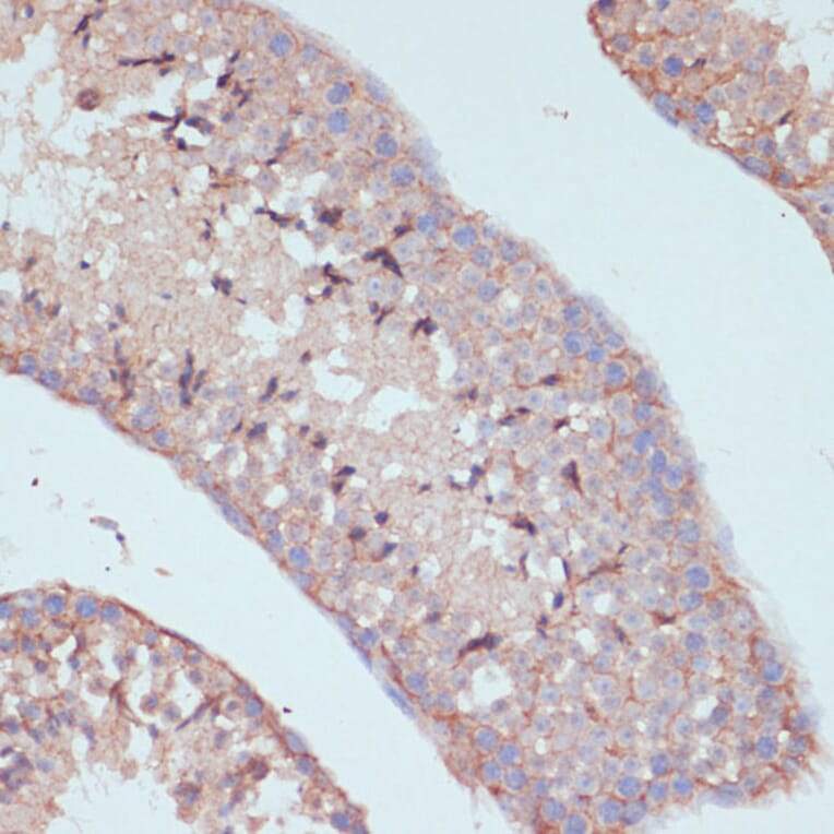 Immunohistochemistry - Anti-ARL4D Antibody (A92538) - Antibodies.com