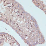 Immunohistochemistry - Anti-ARL4D Antibody (A92538) - Antibodies.com