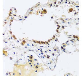 Immunohistochemistry - Anti-ARL6IP4 Antibody (A92539) - Antibodies.com