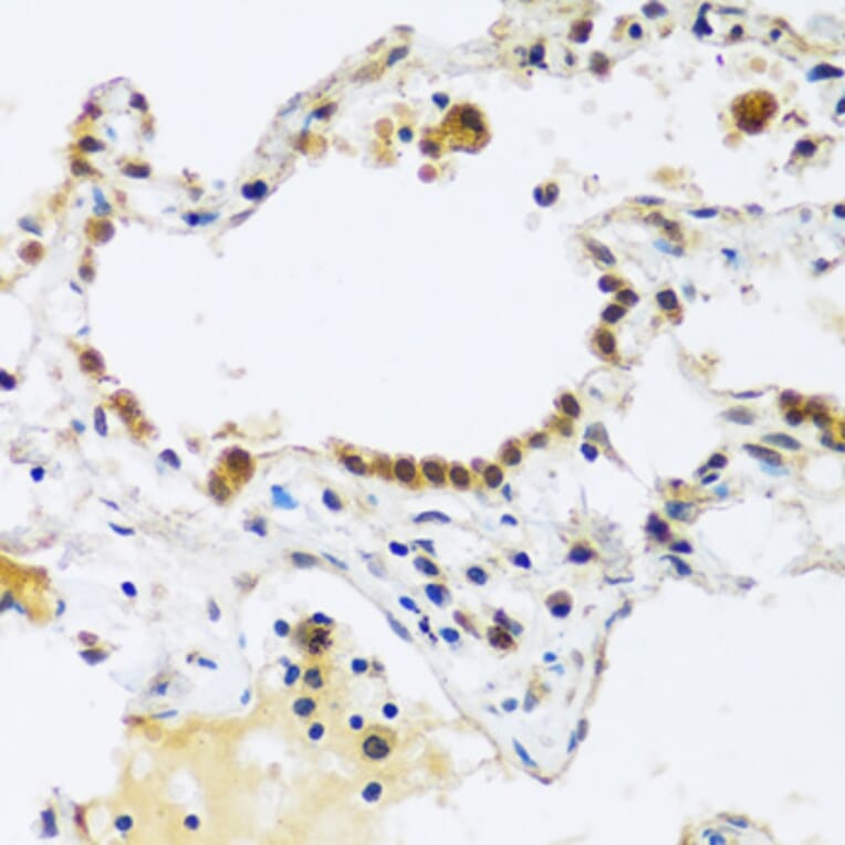 Immunohistochemistry - Anti-ARL6IP4 Antibody (A92539) - Antibodies.com