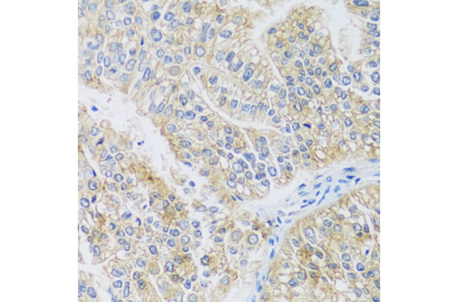 Immunohistochemistry - Anti-ARPC1A Antibody (A17079) - Antibodies.com