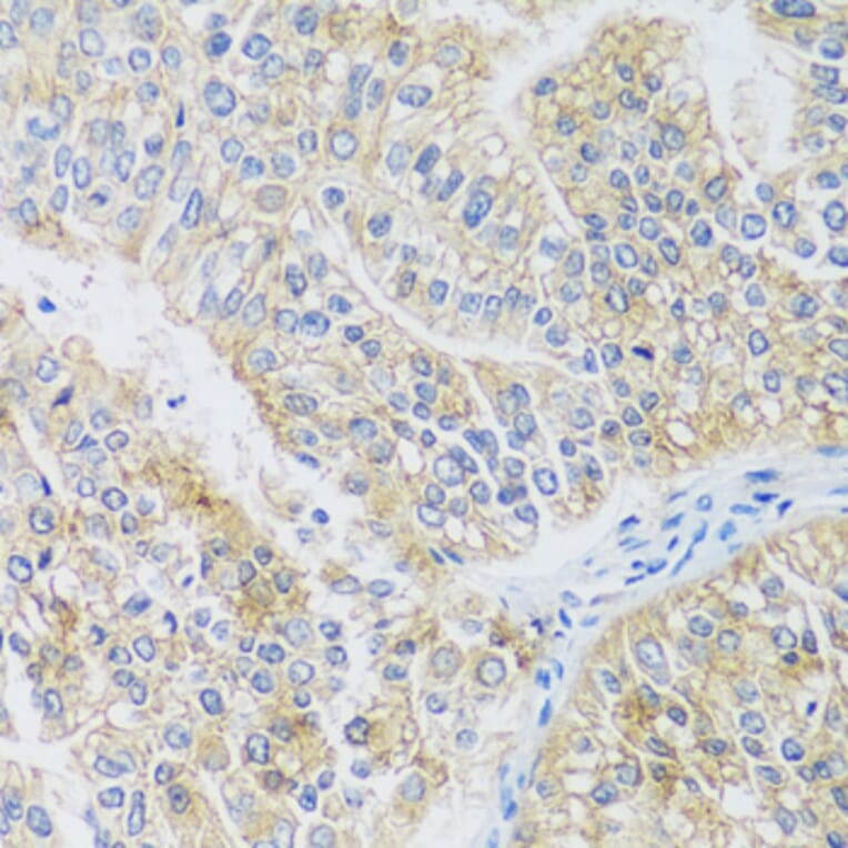 Immunohistochemistry - Anti-ARPC1A Antibody (A17079) - Antibodies.com
