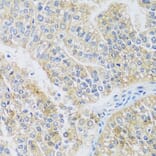 Immunohistochemistry - Anti-ARPC1A Antibody (A17079) - Antibodies.com