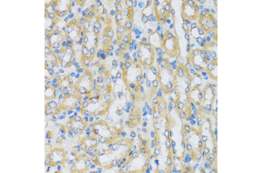 Immunohistochemistry - Anti-ARPC1A Antibody (A17079) - Antibodies.com