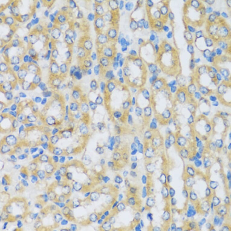 Immunohistochemistry - Anti-ARPC1A Antibody (A17079) - Antibodies.com