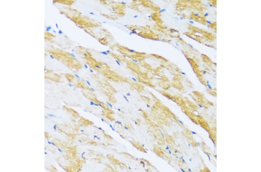 Immunohistochemistry - Anti-ARPC1A Antibody (A17079) - Antibodies.com