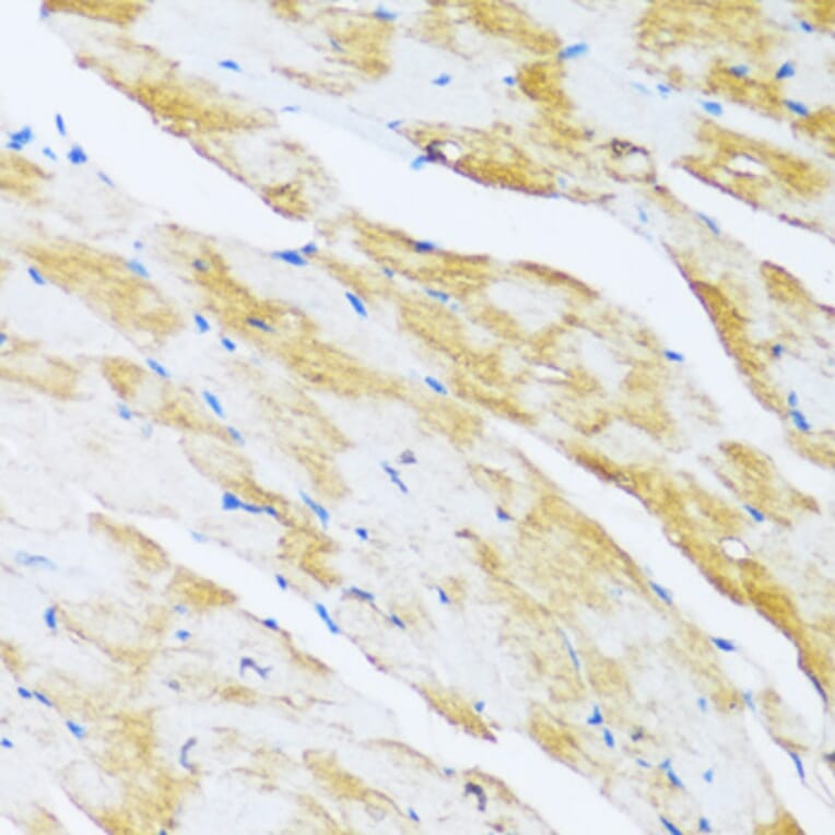 Immunohistochemistry - Anti-ARPC1A Antibody (A17079) - Antibodies.com