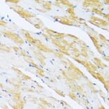 Immunohistochemistry - Anti-ARPC1A Antibody (A17079) - Antibodies.com