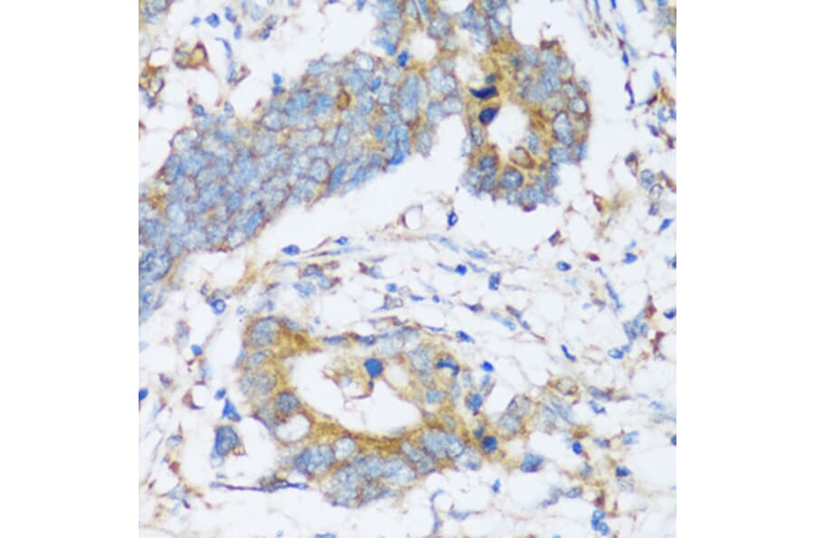 Immunohistochemistry - Anti-ARSB Antibody (A16765) - Antibodies.com