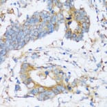 Immunohistochemistry - Anti-ARSB Antibody (A16765) - Antibodies.com