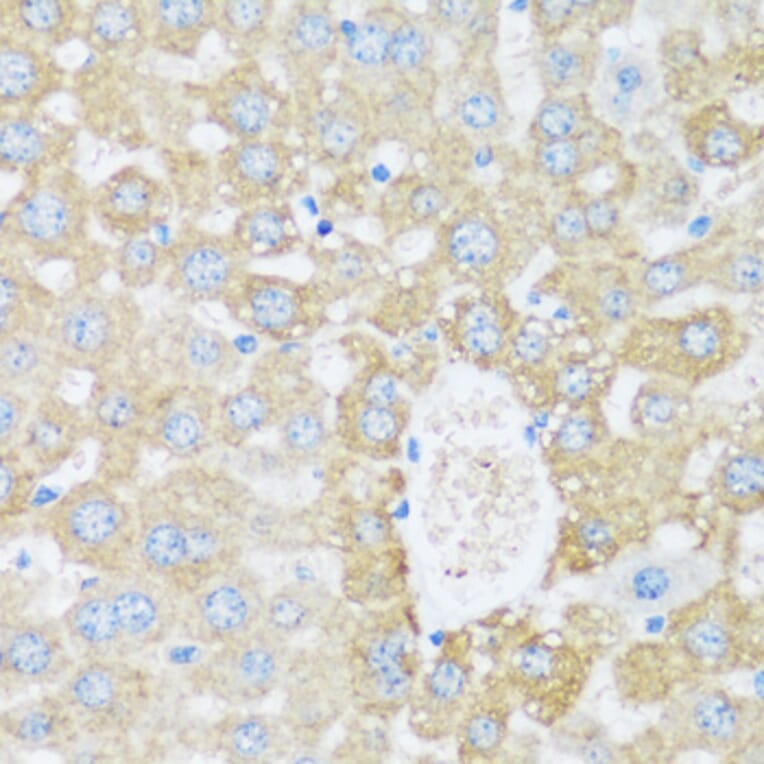 Immunohistochemistry - Anti-ARSB Antibody (A16765) - Antibodies.com