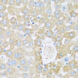 Immunohistochemistry - Anti-ARSB Antibody (A16765) - Antibodies.com