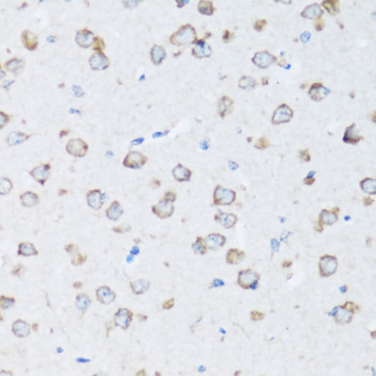 Immunohistochemistry - Anti-ARSB Antibody (A16765) - Antibodies.com