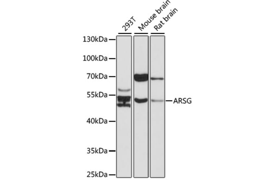 Western Blot - Anti-ARSG Antibody (A17102) - Antibodies.com