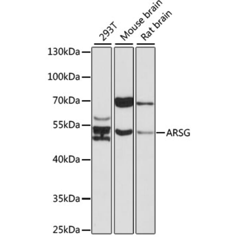 Western Blot - Anti-ARSG Antibody (A17102) - Antibodies.com