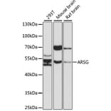 Western Blot - Anti-ARSG Antibody (A17102) - Antibodies.com