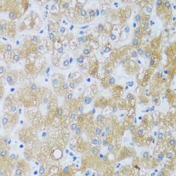 Immunohistochemistry of paraffin-embedded human liver using Anti-ASB4 Antibody (A17159) at dilution of 1:100 (40x lens).