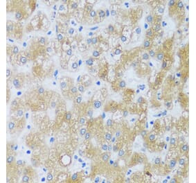 Immunohistochemistry - Anti-ASB4 Antibody (A92543) - Antibodies.com