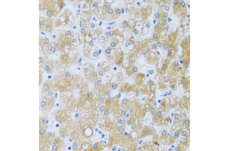 Immunohistochemistry - Anti-ASB4 Antibody (A92543) - Antibodies.com