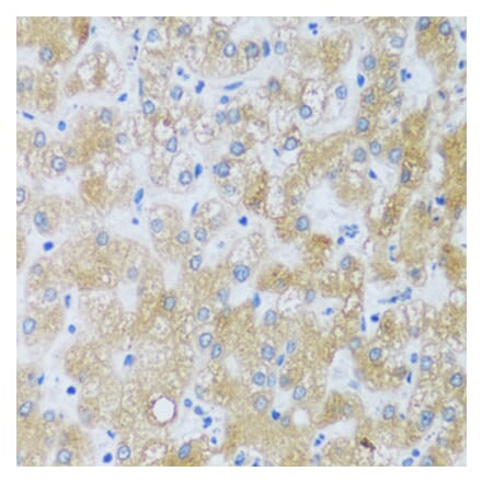 Immunohistochemistry - Anti-ASB4 Antibody (A92543) - Antibodies.com