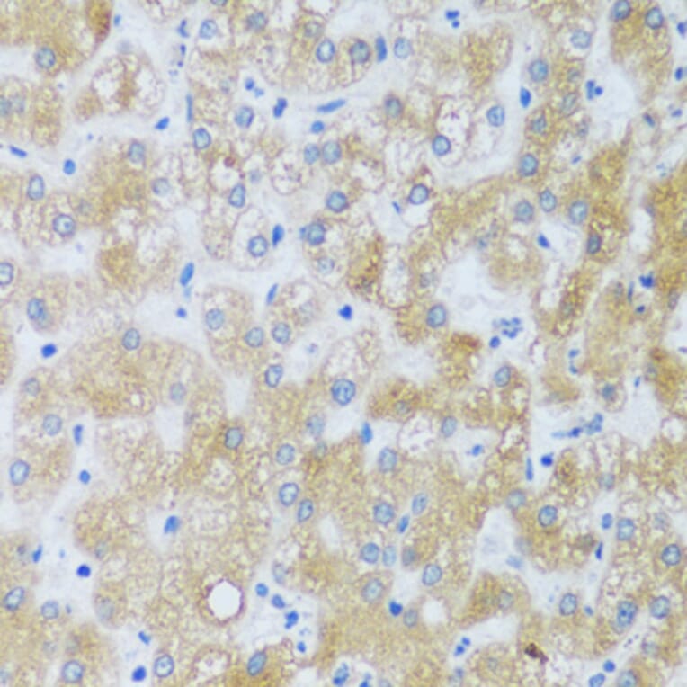 Immunohistochemistry - Anti-ASB4 Antibody (A92543) - Antibodies.com
