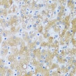 Immunohistochemistry - Anti-ASB4 Antibody (A92543) - Antibodies.com
