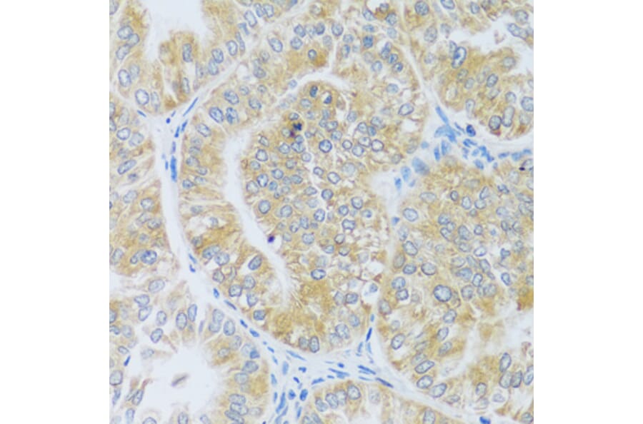 Immunohistochemistry - Anti-ASB4 Antibody (A92543) - Antibodies.com