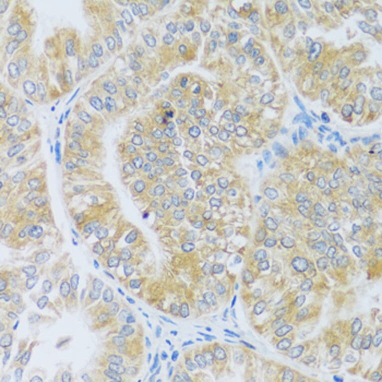 Immunohistochemistry - Anti-ASB4 Antibody (A92543) - Antibodies.com