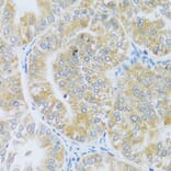 Immunohistochemistry - Anti-ASB4 Antibody (A92543) - Antibodies.com
