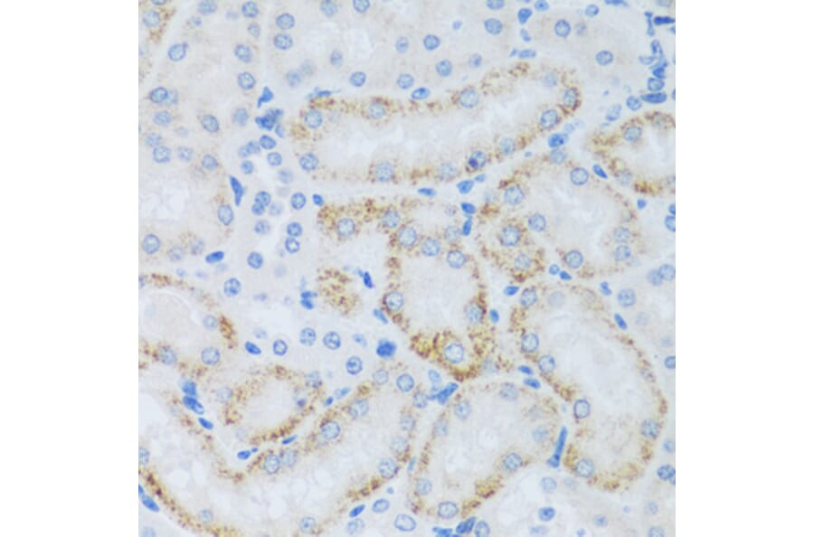 Immunohistochemistry - Anti-ASB4 Antibody (A92543) - Antibodies.com