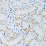 Immunohistochemistry - Anti-ASB4 Antibody (A92543) - Antibodies.com