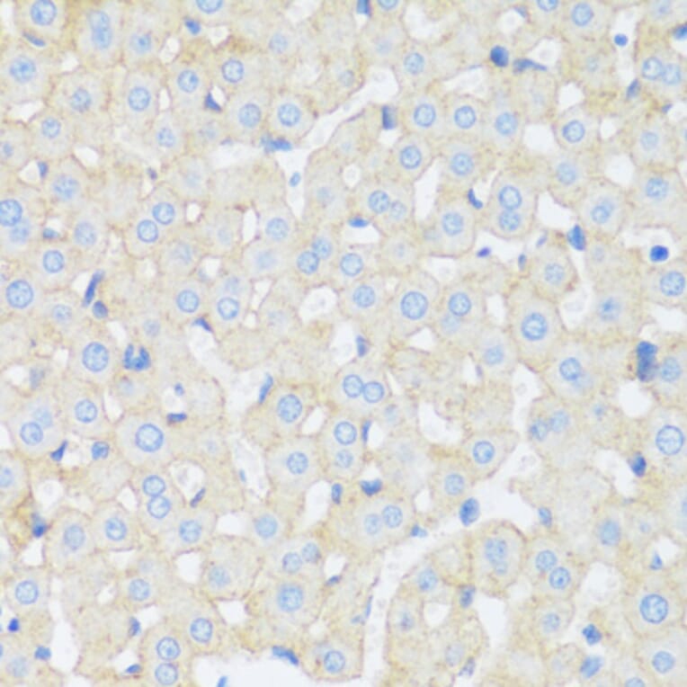 Immunohistochemistry - Anti-Asialoglycoprotein Receptor 1 / HL-1 Antibody (A92544) - Antibodies.com