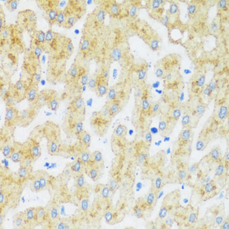 Immunohistochemistry - Anti-Asialoglycoprotein Receptor 1 / HL-1 Antibody (A92544) - Antibodies.com