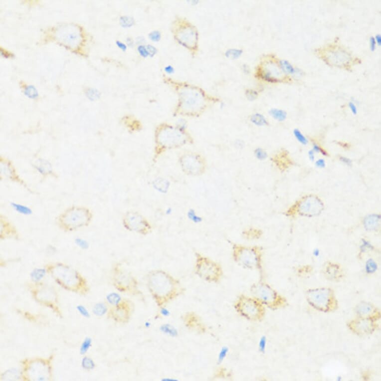 Immunohistochemistry - Anti-ASIC4 Antibody (A17179) - Antibodies.com