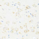 Immunohistochemistry - Anti-ASIC4 Antibody (A17179) - Antibodies.com