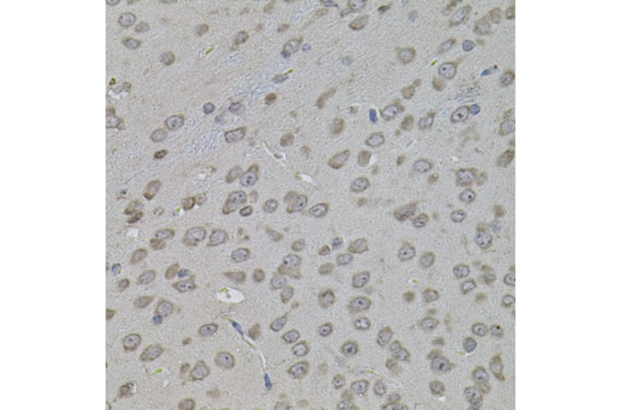 Immunohistochemistry - Anti-ATF4 Antibody (A7237) - Antibodies.com