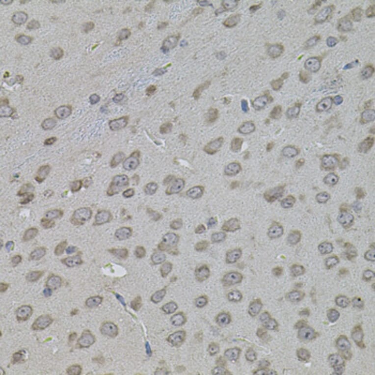 Immunohistochemistry - Anti-ATF4 Antibody (A7237) - Antibodies.com