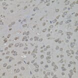 Immunohistochemistry - Anti-ATF4 Antibody (A7237) - Antibodies.com