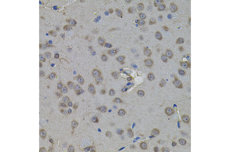 Immunohistochemistry - Anti-ATF4 Antibody (A7237) - Antibodies.com