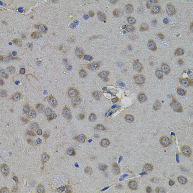 Immunohistochemistry - Anti-ATF4 Antibody (A7237) - Antibodies.com