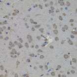 Immunohistochemistry - Anti-ATF4 Antibody (A7237) - Antibodies.com