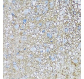 Immunohistochemistry - Anti-ATP1B2 Antibody (A92547) - Antibodies.com